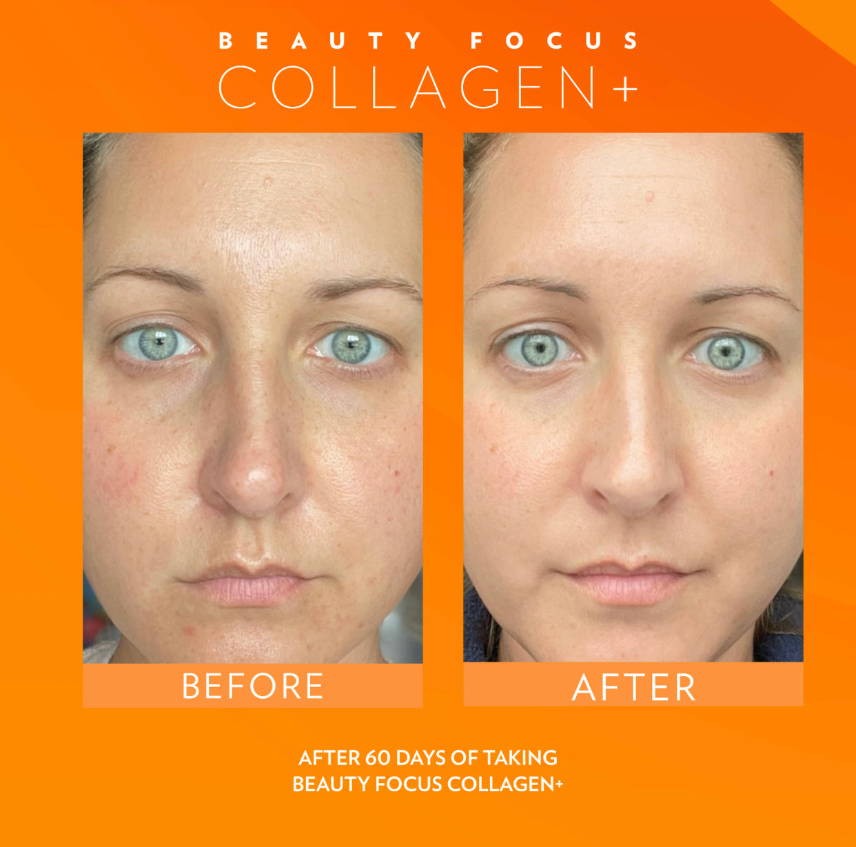 Beauty Focus Collagen - Peach